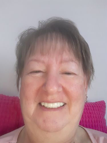 Customer photo review of Teeth-Veneer 2.0