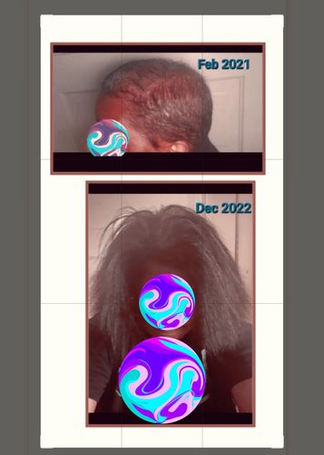 Customer photo review of [Step 6] HAIR BOOST: Nae Nae's Flagship Product