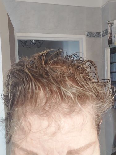 Customer photo review of Good Hair Vitamins Boost - 6 mois