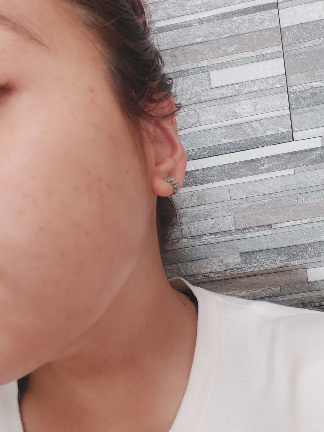 Customer photo review of Hyaluronic Acid 2% + B5 Hydrating Serum