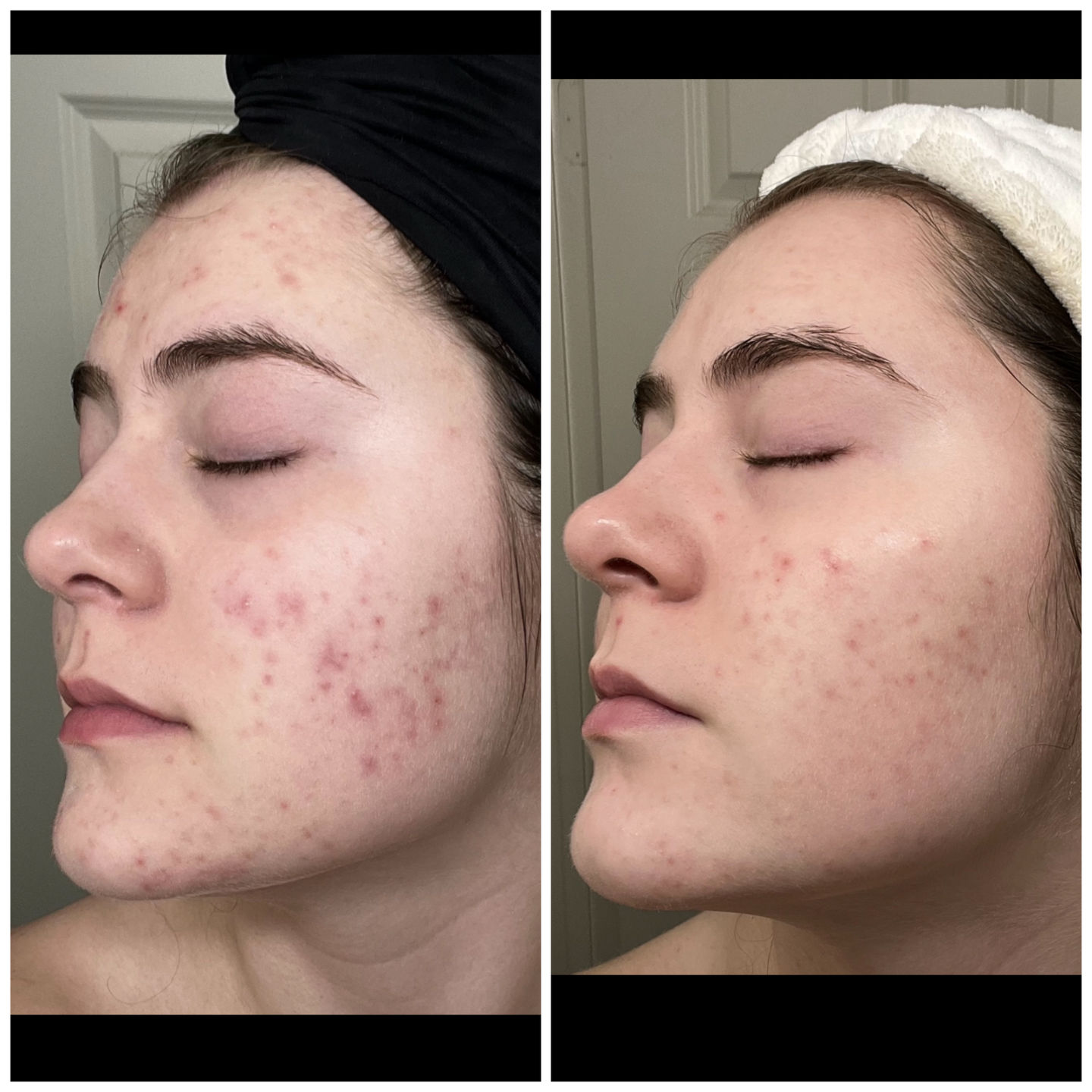 Customer photo review of AndroEase Plus