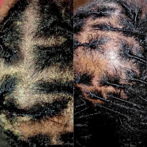 Customer photo review of Scalp Bundle