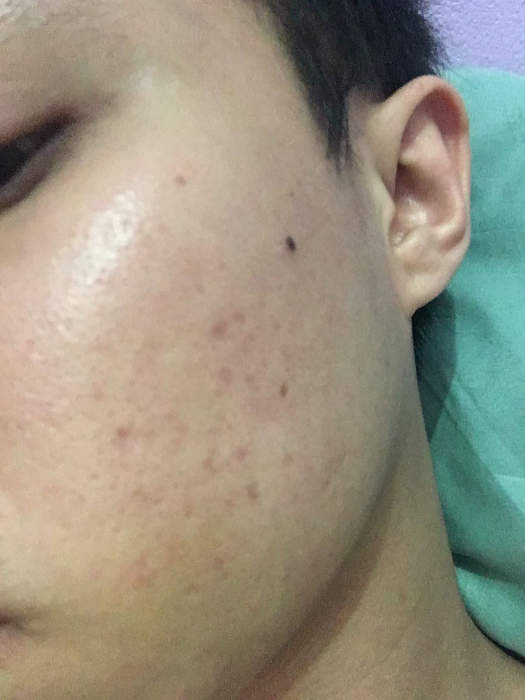 Customer photo review of Face Set