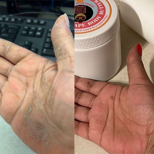 Customer photo review of Signature Body Butter