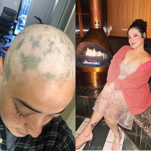 Customer photo review of Growth & Hydration Combo