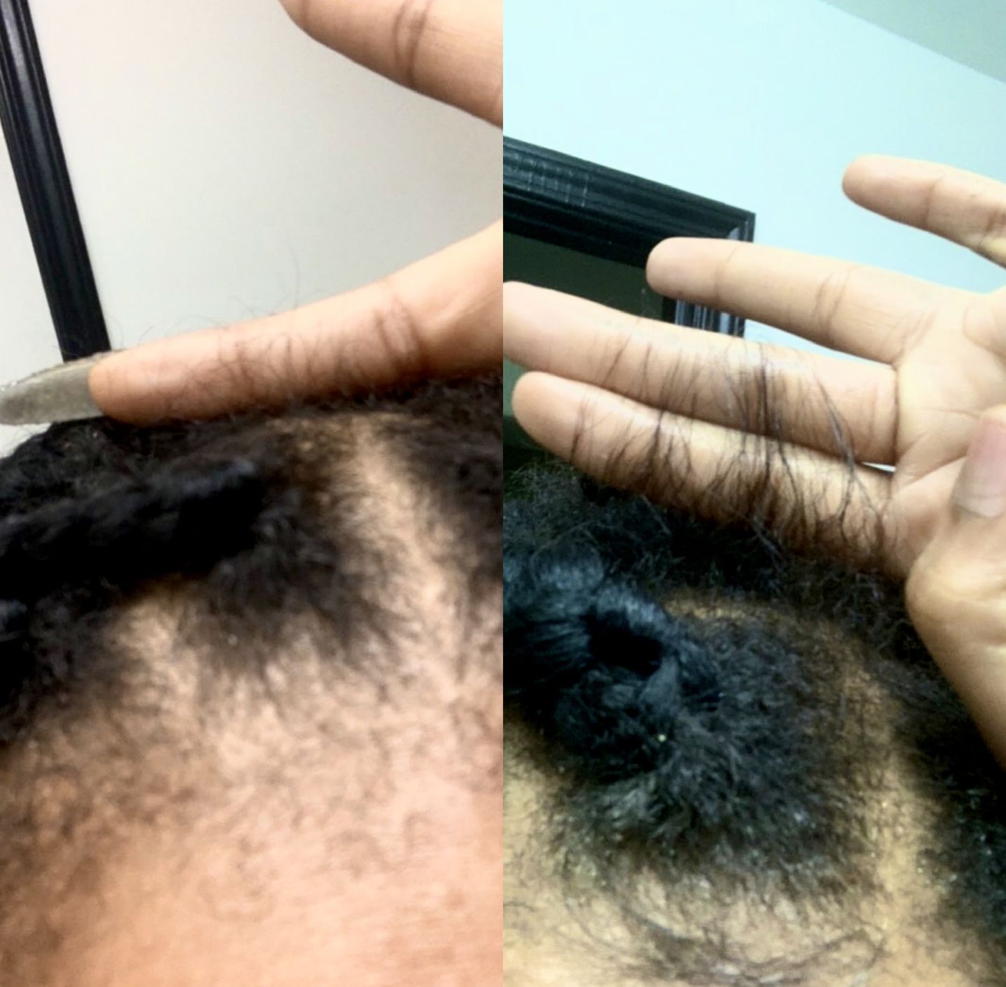 Customer photo review of Growth & Hydration Combo