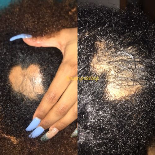 Customer photo review of Growth & Hydration Combo