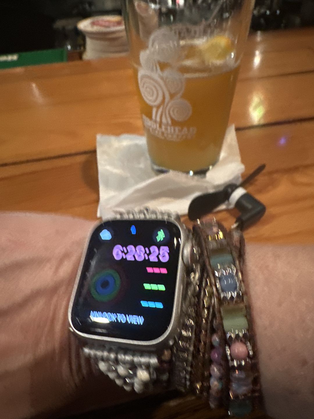 Customer photo review of Healing Turquoise Protection Apple Watch Strap