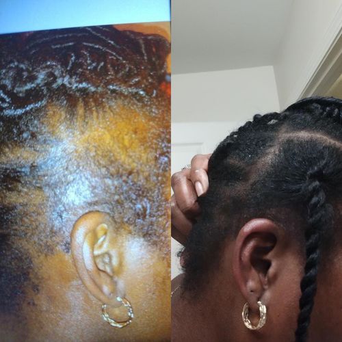 Customer photo review of Growth & Hydration Combo