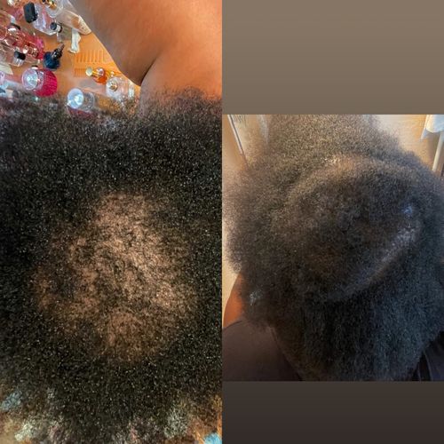 Customer photo review of Growth & Hydration Combo