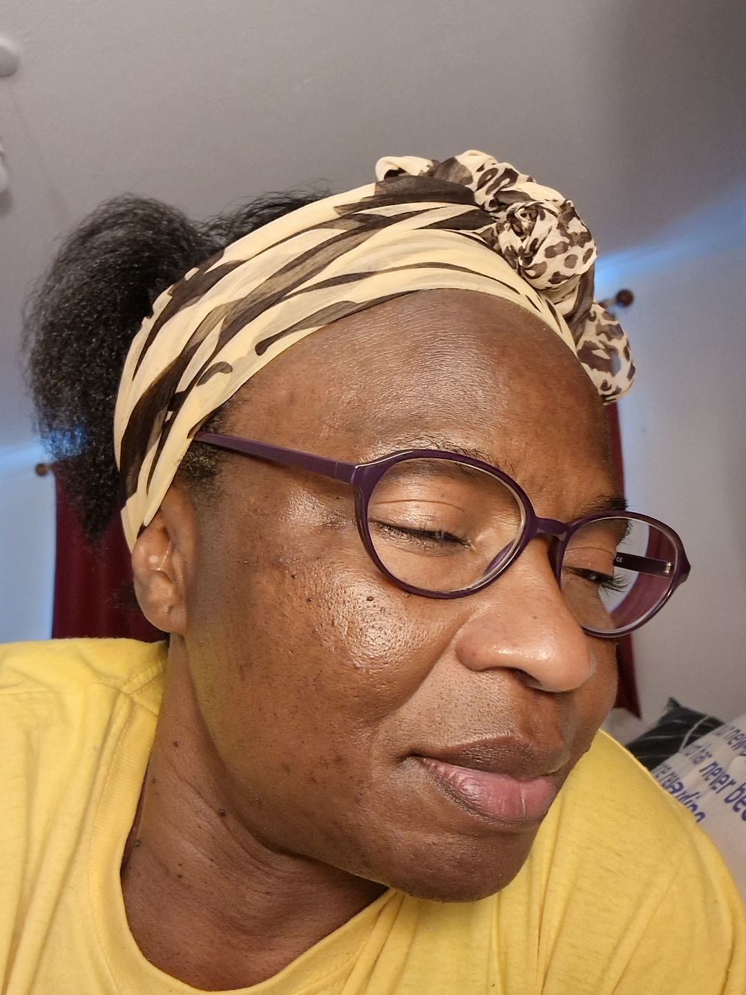 Customer photo review of Extra Strength Dark Spot Corrector