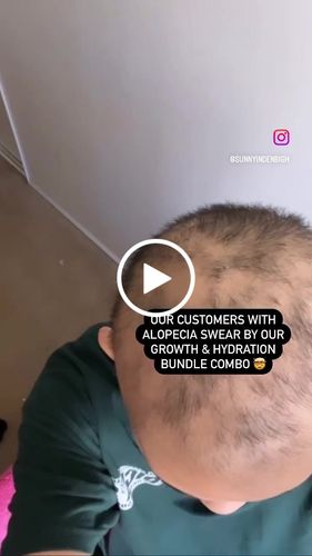 Customer video review of Growth & Hydration Combo