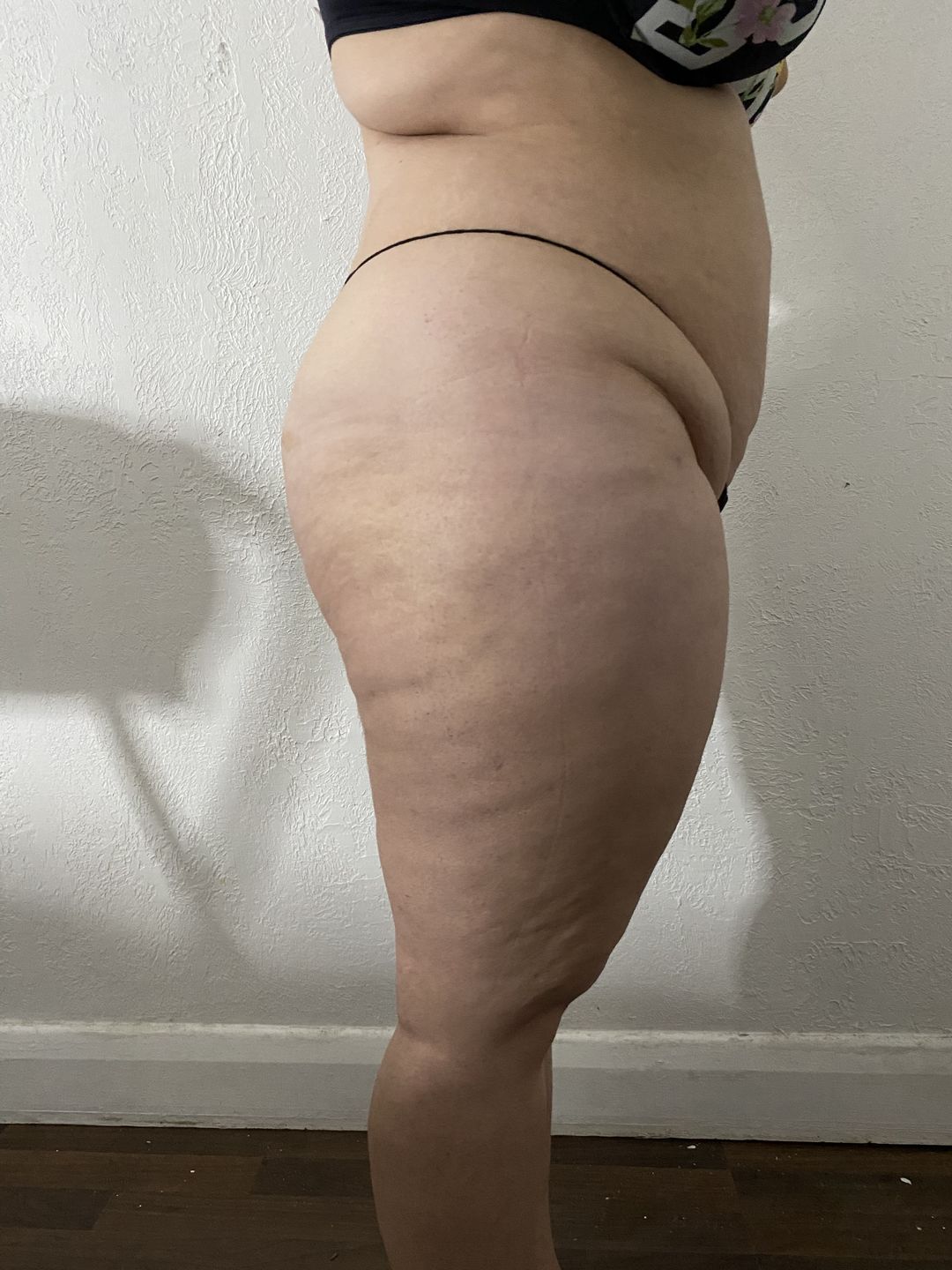 Customer photo review of Lipolimus Extracto de Alcachofa - Denova - Adelgazante y Anticelulítico
