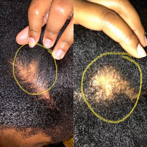 Customer photo review of Growth & Hydration Combo