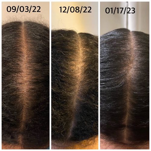 Customer photo review of Intensive Scalp Oil