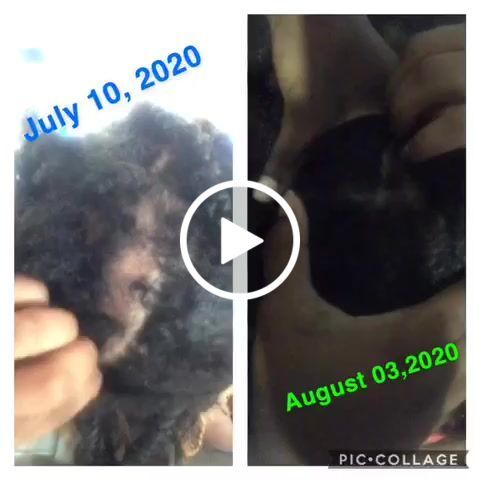 Customer video review of Growth & Hydration Combo