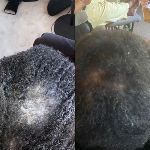 Customer photo review of Growth & Hydration Combo