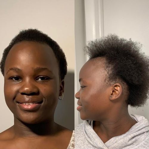 Customer photo review of Intensive Scalp Oil