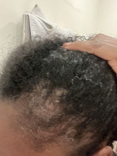 Customer photo review of Eden - Total Hair Wealth Bundle