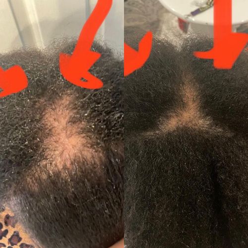 Customer photo review of Growth & Hydration Combo