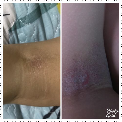 Customer photo review of Jolicare Cream