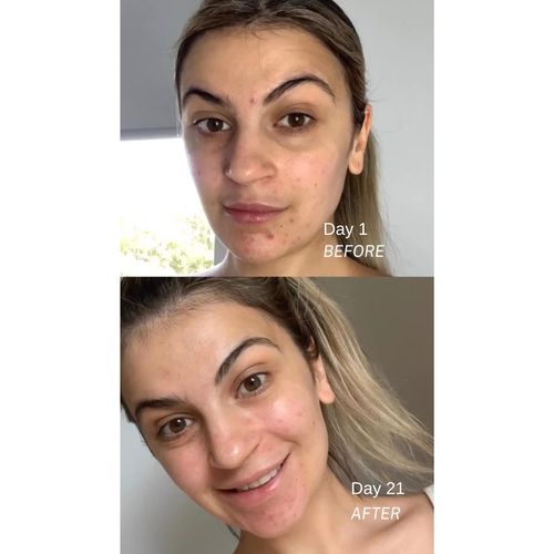 Customer photo review of CLARIFYING MOISTURISER