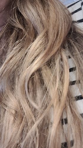 Customer photo review of ערכה דו שלבית לטיפול בקשקשים | SEBO DANDRUFF KIT