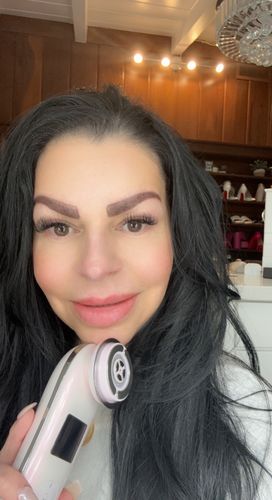 Customer photo review of EvenSkyn® Lumo: Premium Anti-Aging & Skin Tightening Handset
