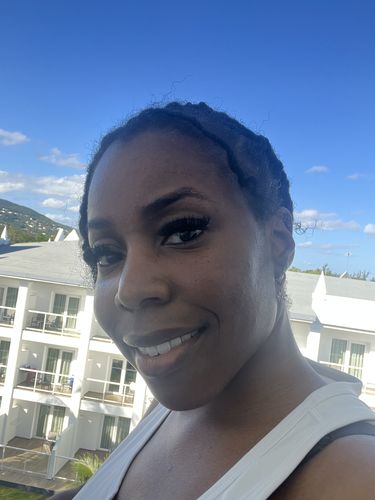 Customer photo review of BERRI-CLEAR+ 5 BERRY SUPERFRUIT SERUM