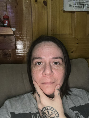 Customer photo review of (Buffet)Multi-Peptide + Hyaluronic Acid Serum 30ml