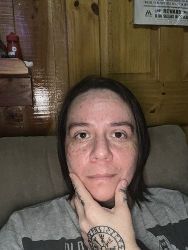 Customer photo review of AHA 30% + BHA 2% Peeling Solution 30 mL