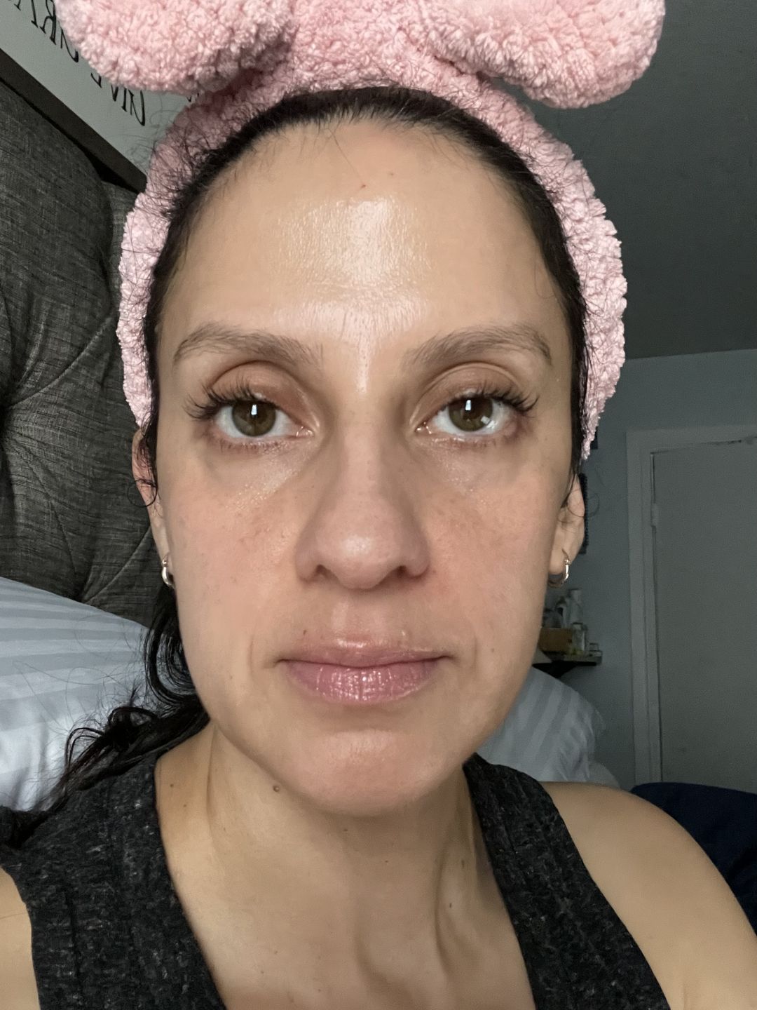 Customer photo review of 14% Jessner Skin Peel 🌿🍃🌱 Everything you need to do a skin peel! 🤩