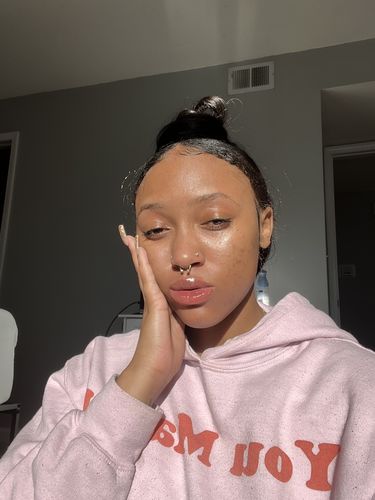 Customer photo review of BERRI-CLEAR+ 5 BERRY SUPERFRUIT SERUM