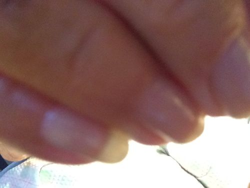 Customer photo review of Rocket Nail Fuel Nail Repair - Clear