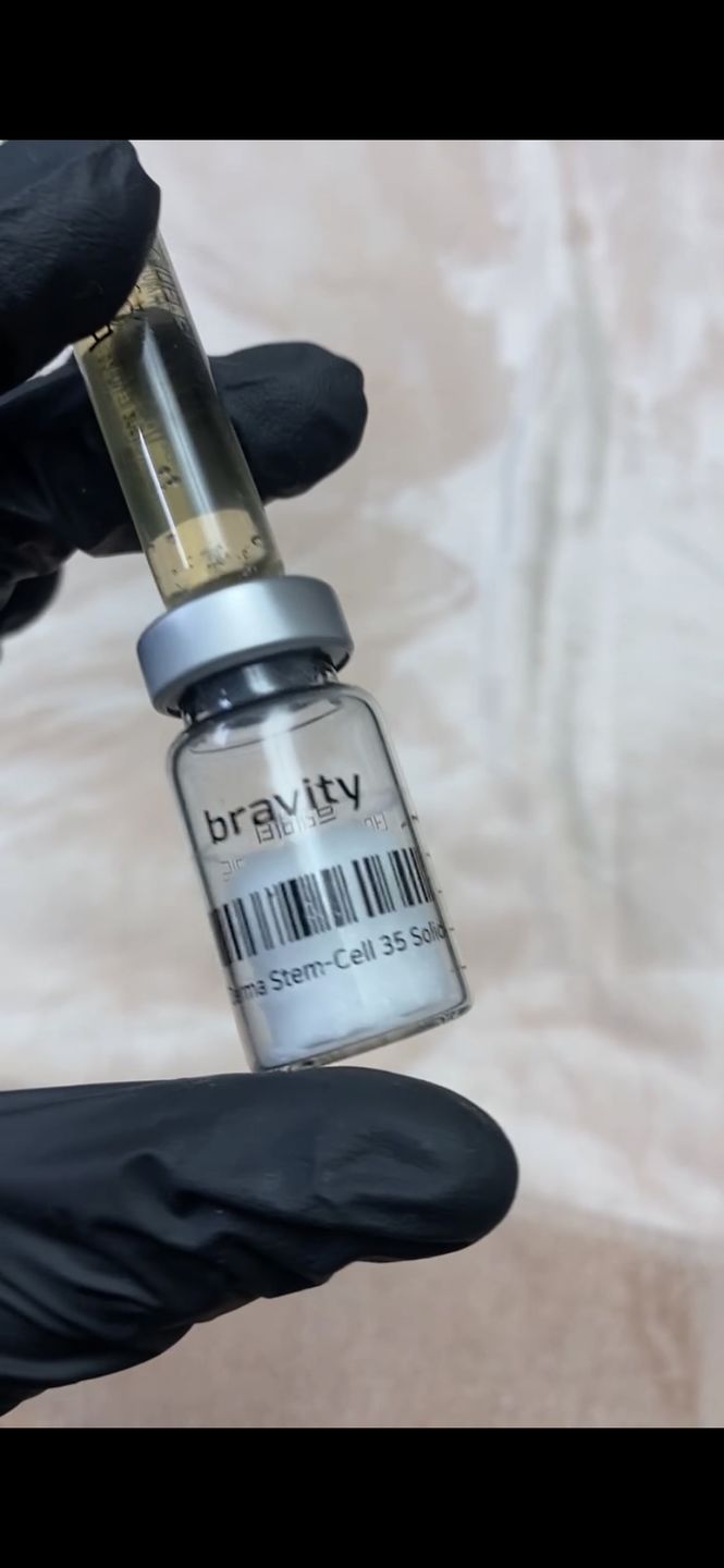 Customer photo review of Bravity Derma Stem Cell 35 Treatment Kit