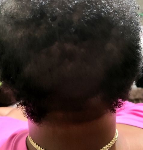 Customer photo review of Eden - Total Hair Wealth Bundle