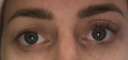 Customer photo review of SimplyLash kit