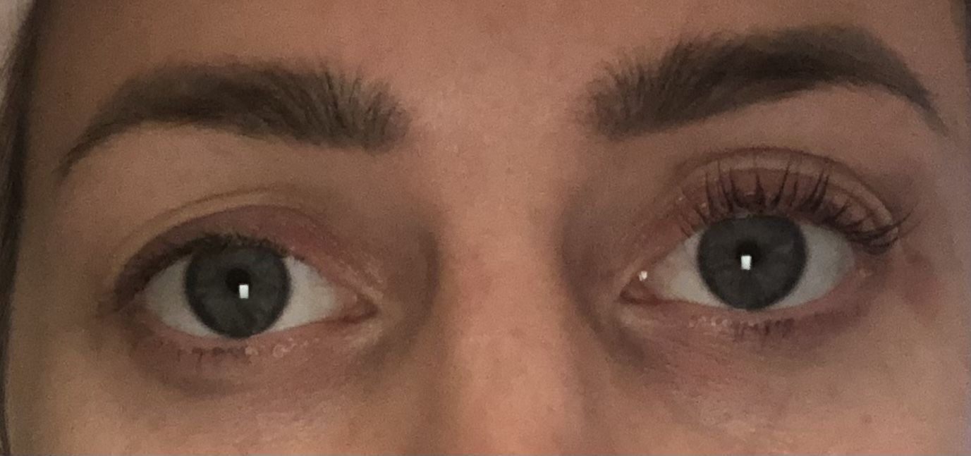 Customer photo review of SimplyLash kit