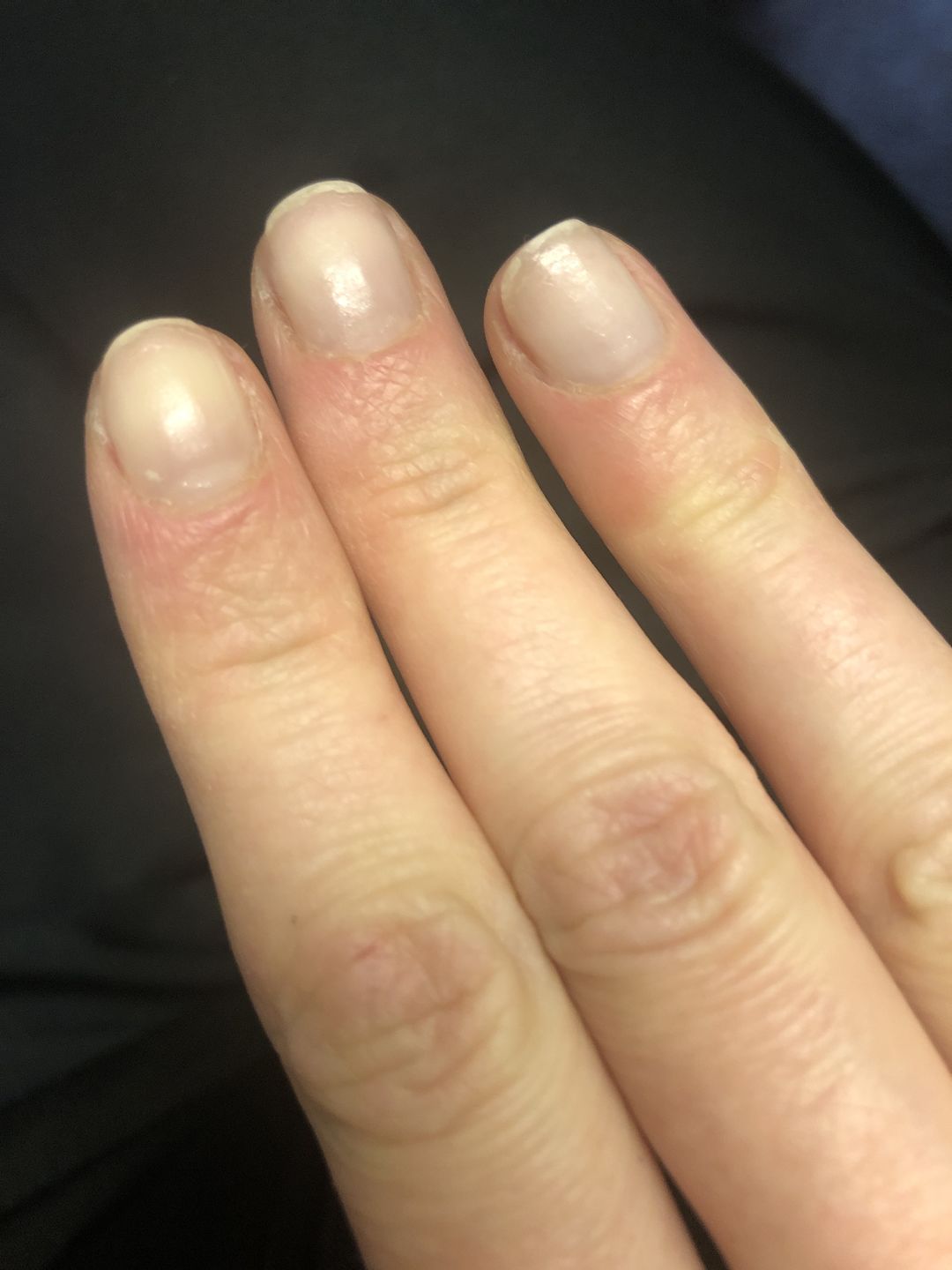 Customer photo review of Semilac Primer Acid Free for Nail Gel Polish 7 ml