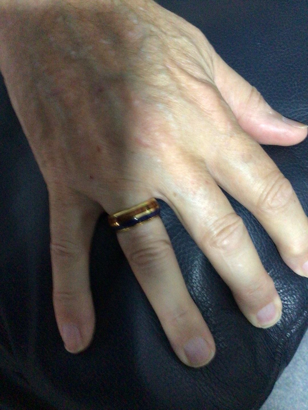 Customer photo review of The Golden Blue 8mm Wonder Ring