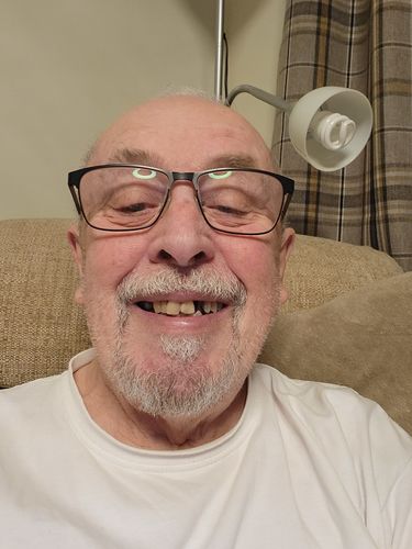 Customer photo review of Teeth-Veneer 2.0