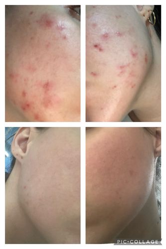 Isabelle K. review of Organic Qasil Powder for Hair and Skin, Pack of 1, 150gm image 1 out of 1