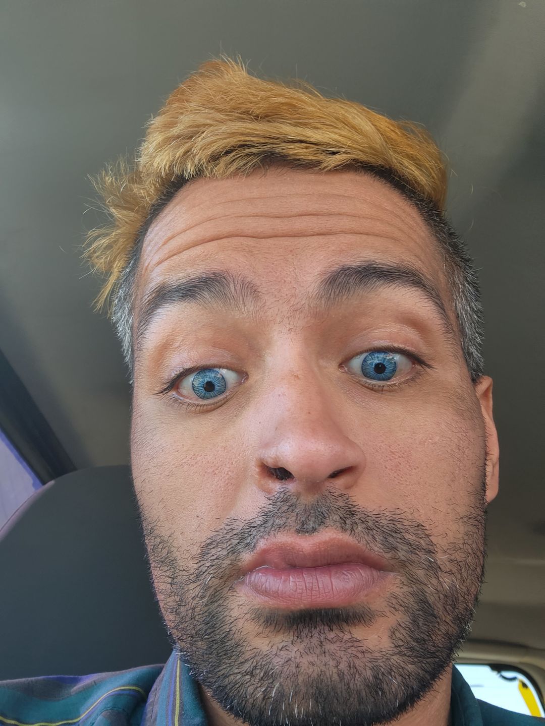 Customer photo review of New York Blue Prescription Coloured Contact Lenses