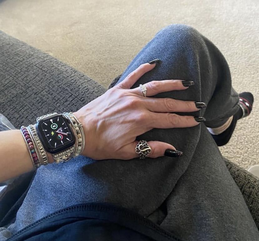 Customer photo review of Healing Turquoise Protection Apple Watch Strap