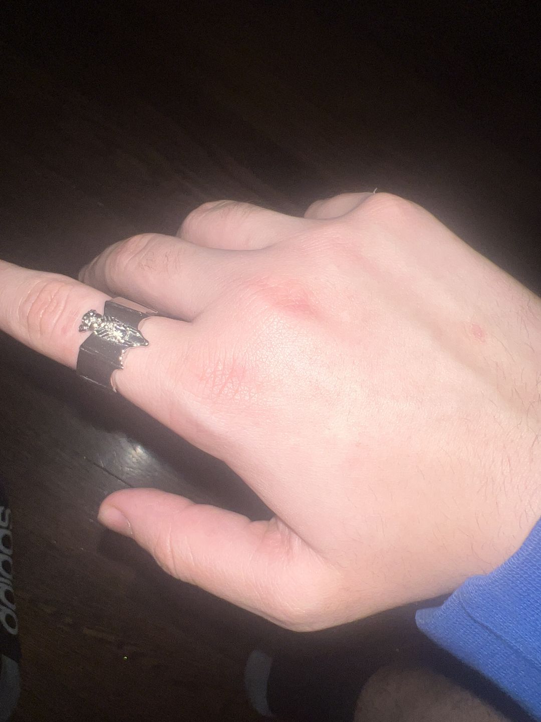 Customer photo review of BAT RING