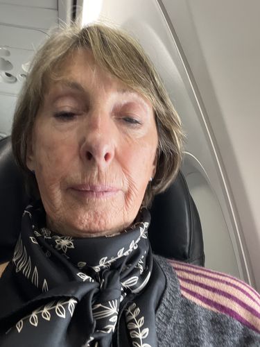 Customer photo review of EvenSkyn® Lumo: Premium Anti-Aging & Skin Tightening Handset