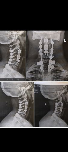 Customer photo review of North Carolina Sweet Ginger Rub