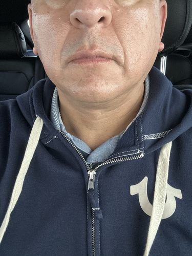 Customer photo review of EvenSkyn® Lumo: Premium Anti-Aging & Skin Tightening Handset