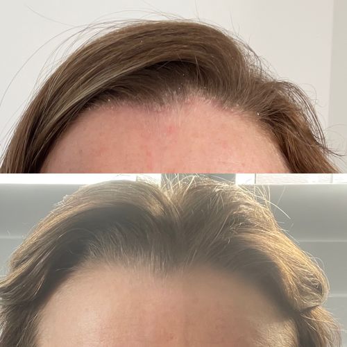 Customer photo review of Shampoo