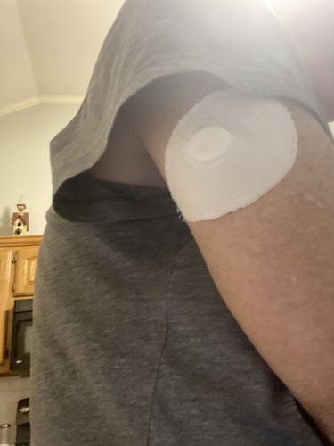 Customer photo review of Skin Grip Original - Freestyle Libre Adhesive Patches